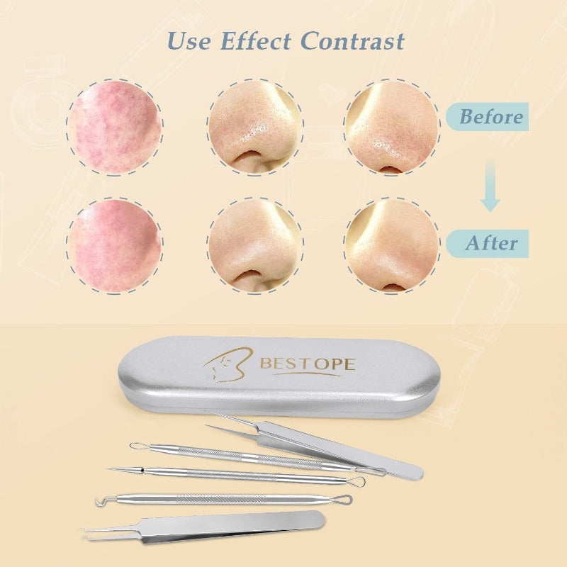 Ustar BESTOPE 26 PCs Makeup Set, 20pcs Brushes & 6pcs Blackhead Remover Pimple Extractor Tool
