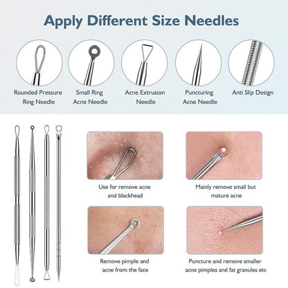 Blackhead Remover Pimple Popper Tool