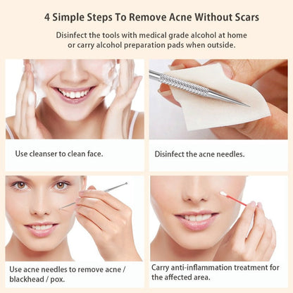 BESTOPE Blackhead Remover Pimple Extractor Tool With De La Cruz 10% Sulfur Ointment Acne Medication
