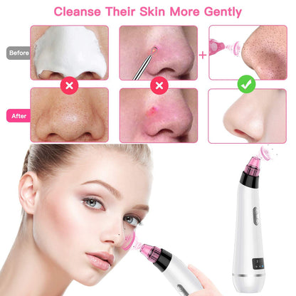 Blackhead Remover Vacuum Pore Cleaner